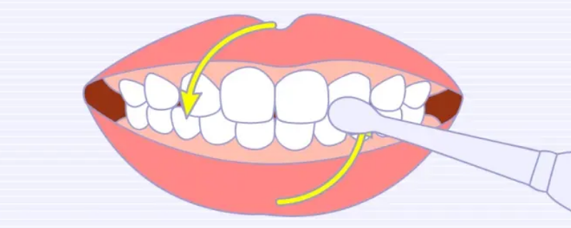 圓弧刷牙法