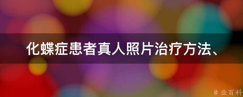 化蝶症患者真人照片_治疗方法、案例分享、心理建设